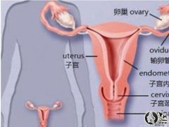 女性质宫囊肿是怎么引起的 子宫囊肿必要留意些什么