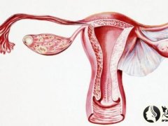 双子宫是怎么回事 是子宫重复性发育异常